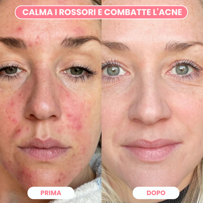 Maschera bio collagene al salmone (Box da 4 maschere)